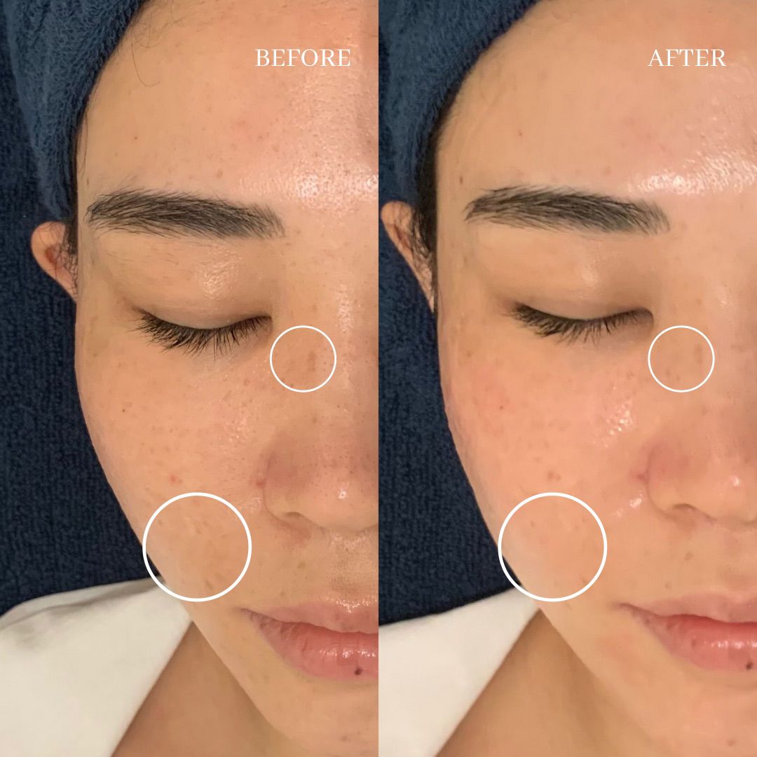 eye luxe_eyelash extention singapore_facial 1