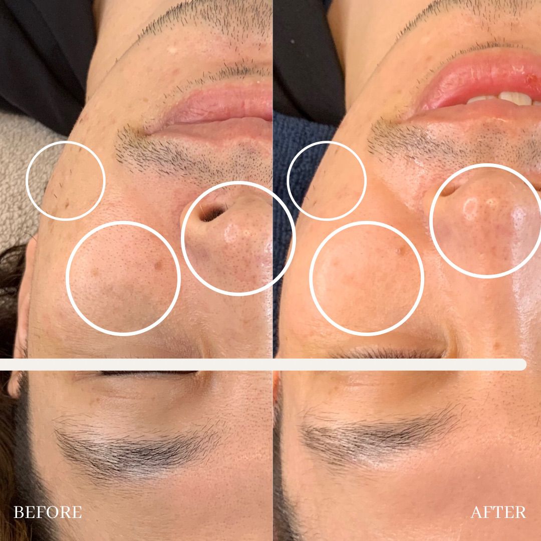 eye luxe_eyelash extention singapore_facial 10