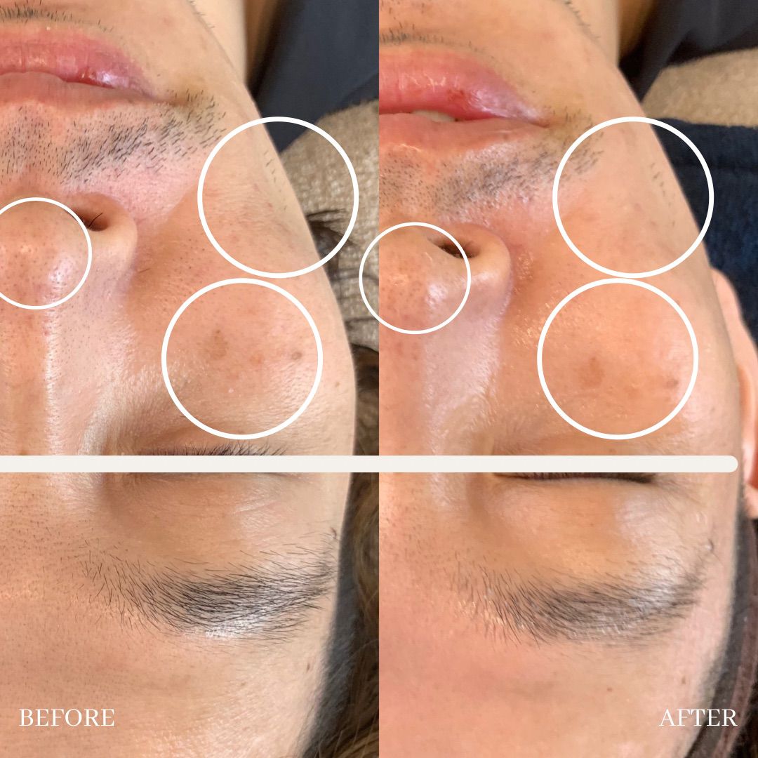 eye luxe_eyelash extention singapore_facial 11