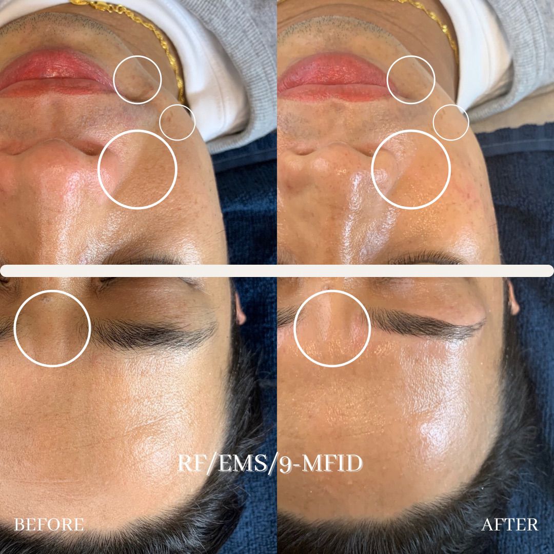 eye luxe_eyelash extention singapore_facial 12