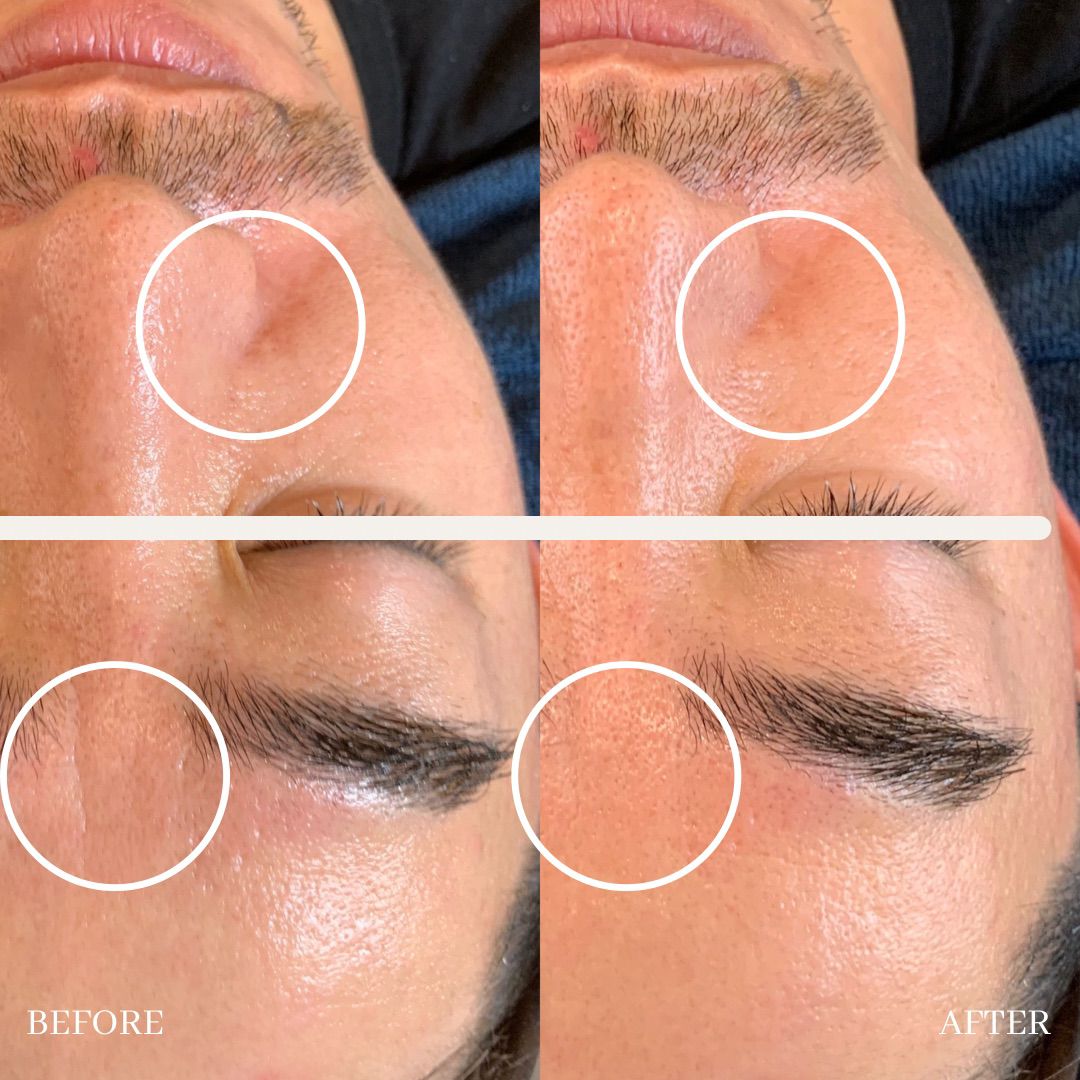 eye luxe_eyelash extention singapore_facial 13