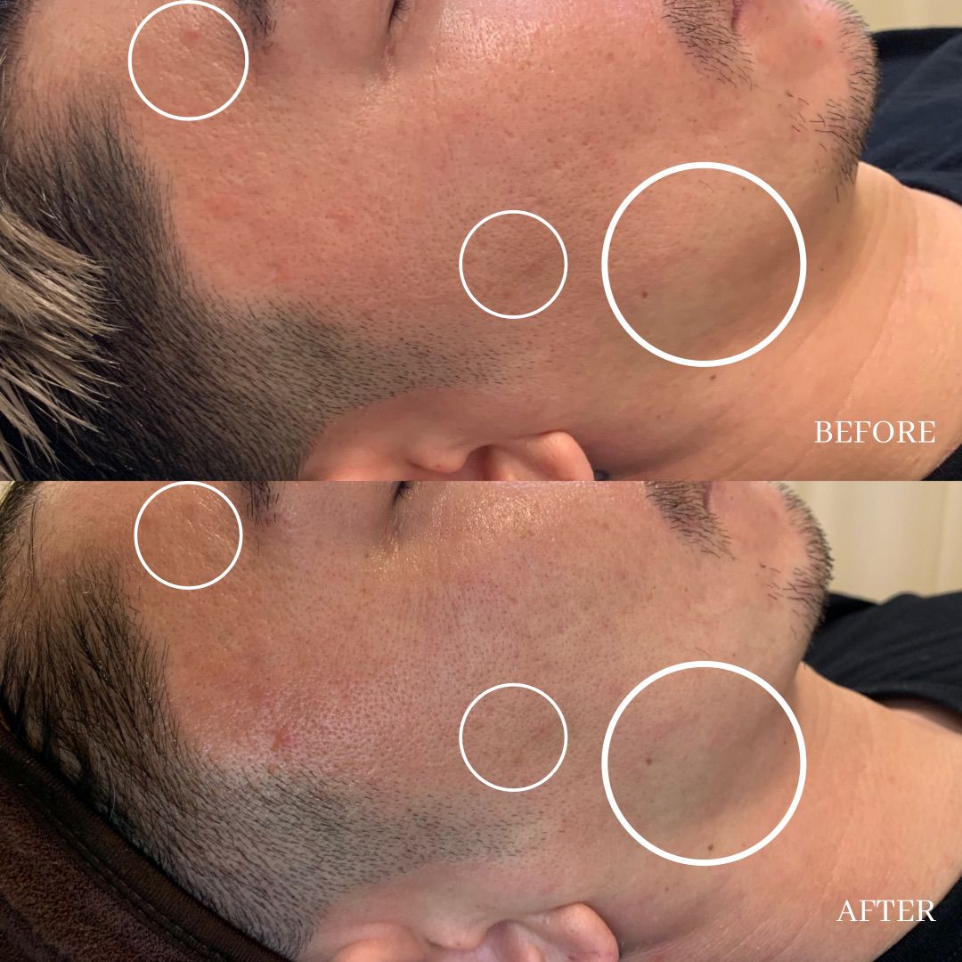 eye luxe_eyelash extention singapore_facial 14