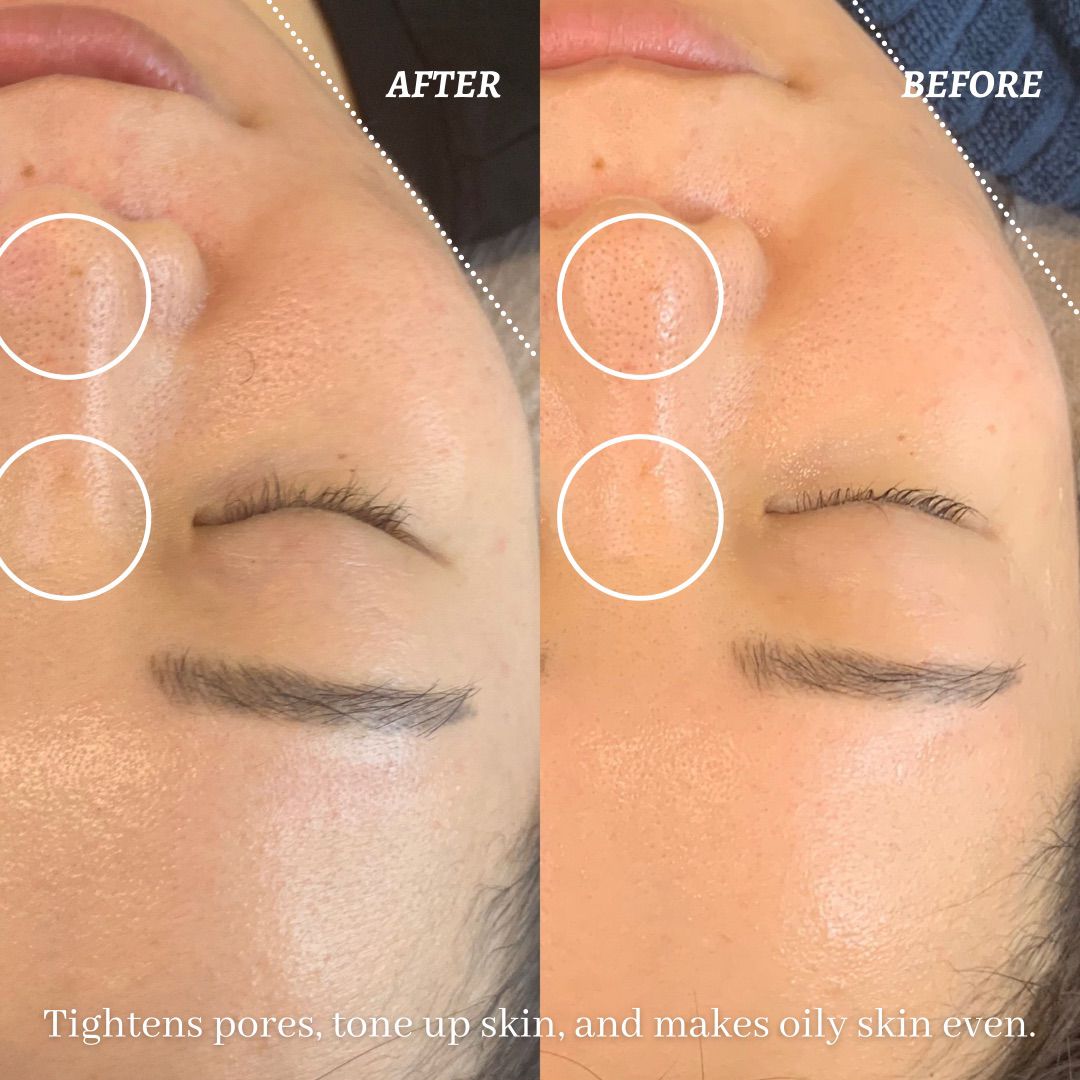 eye luxe_eyelash extention singapore_facial 3