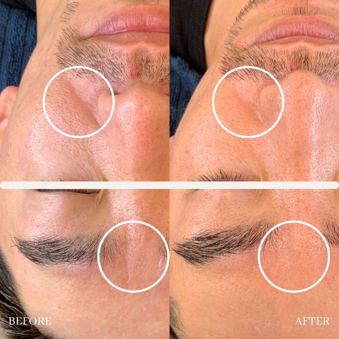 eye luxe_eyelash extention singapore_facial 4