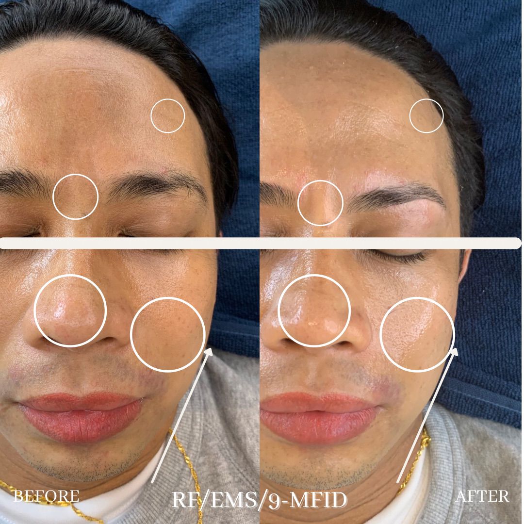 eye luxe_eyelash extention singapore_facial 7