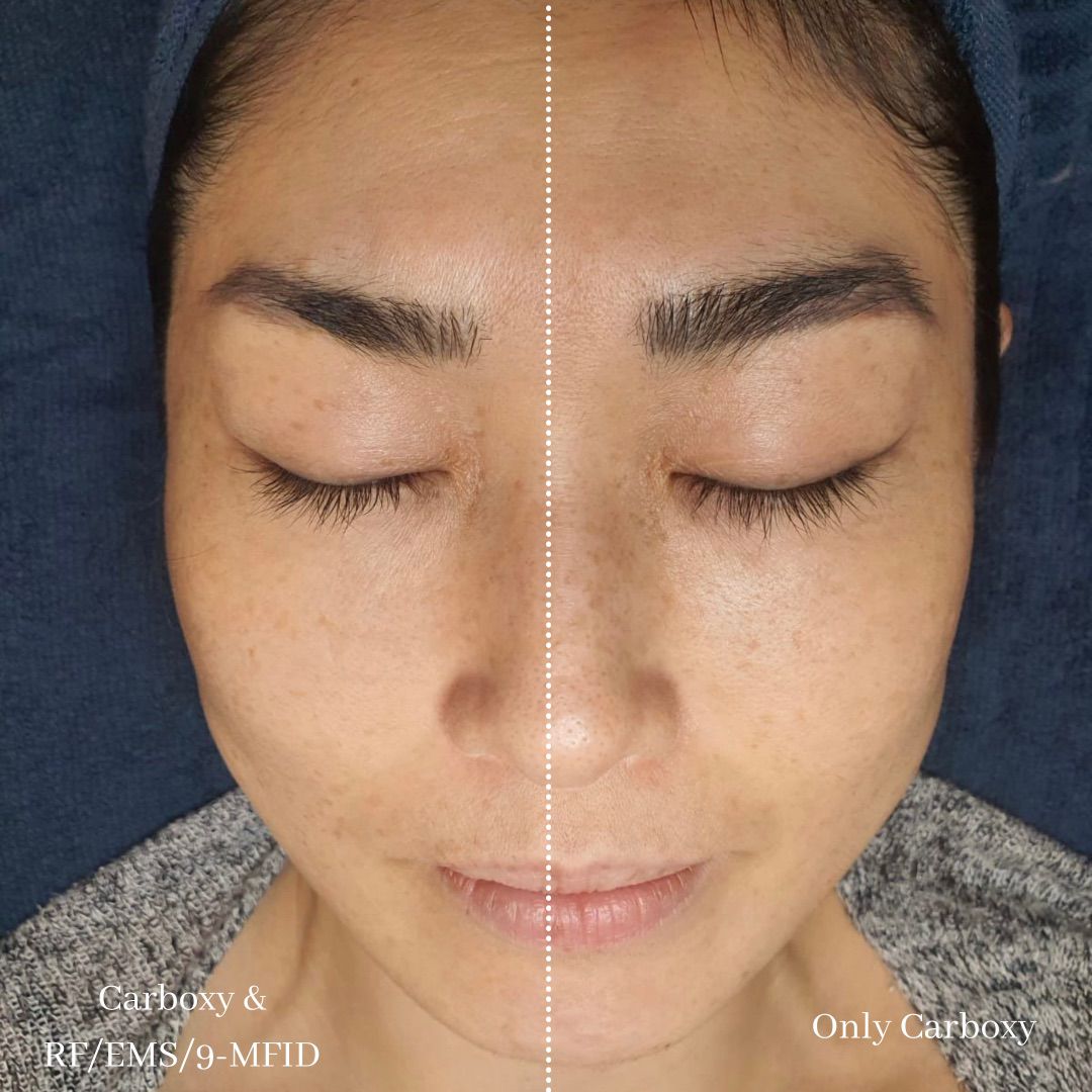 eye luxe_eyelash extention singapore_facial 9